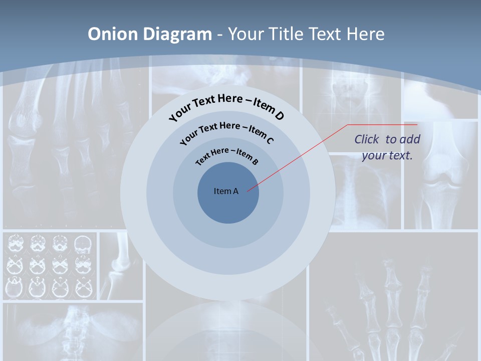 Radiation Shin Bones PowerPoint Template