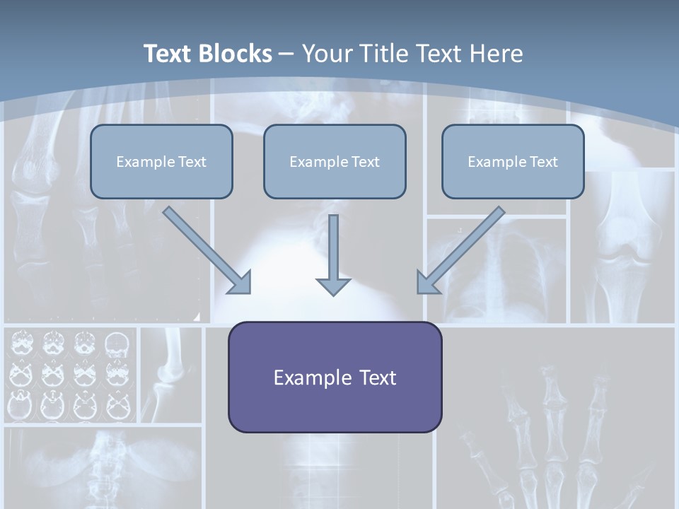Radiation Shin Bones PowerPoint Template