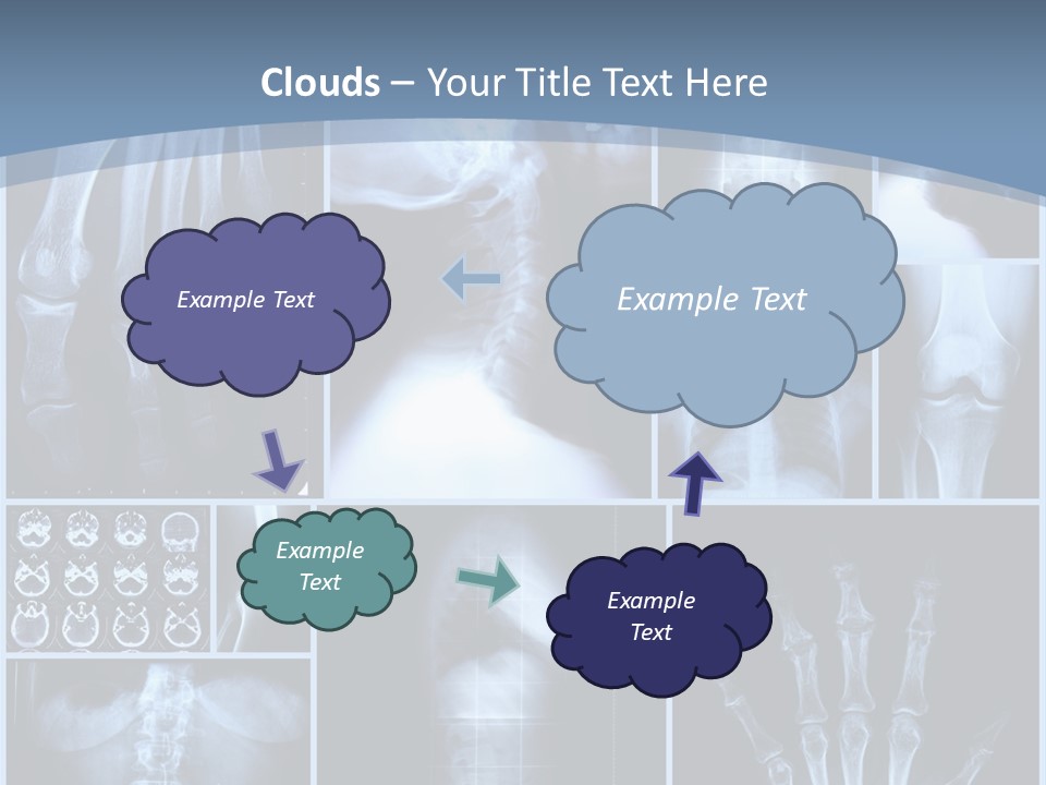 Radiation Shin Bones PowerPoint Template