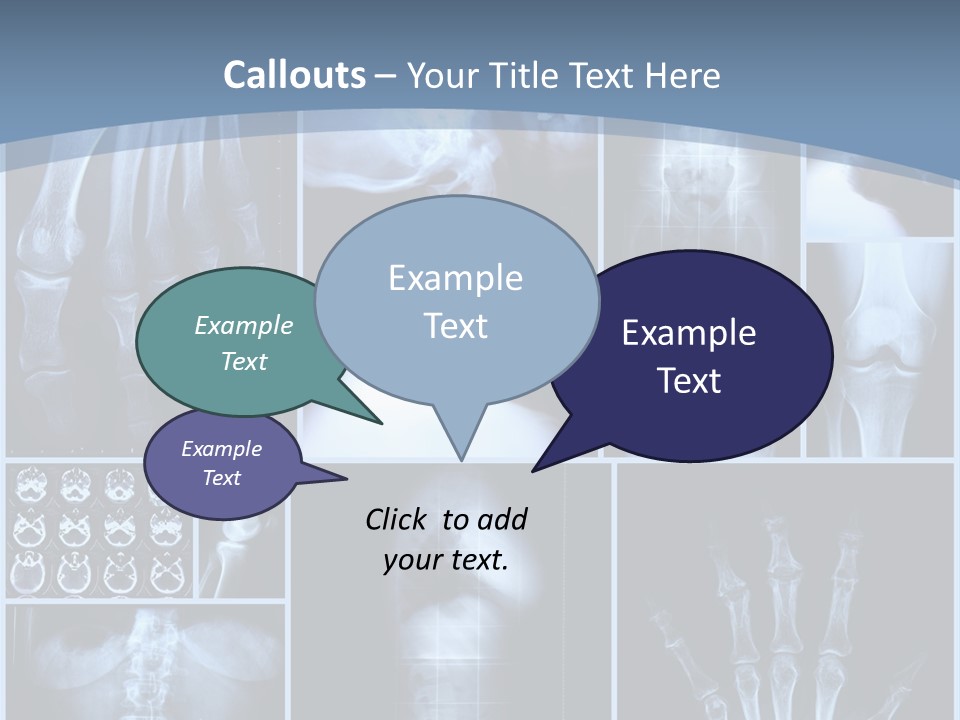Radiation Shin Bones PowerPoint Template