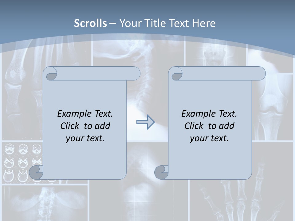Radiation Shin Bones PowerPoint Template