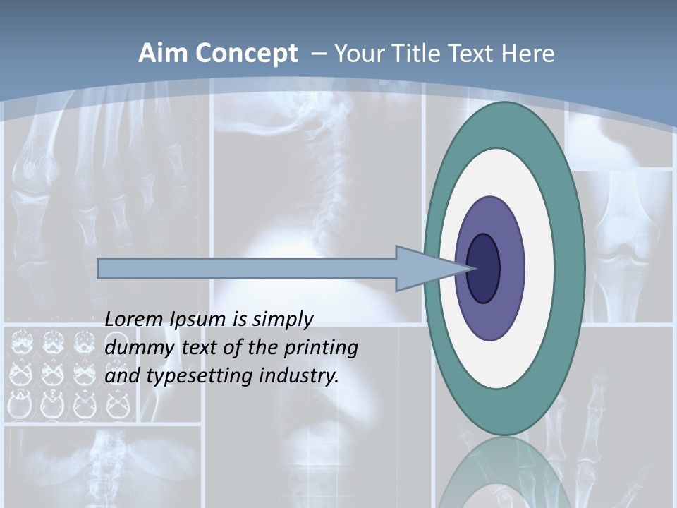 Radiation Shin Bones PowerPoint Template