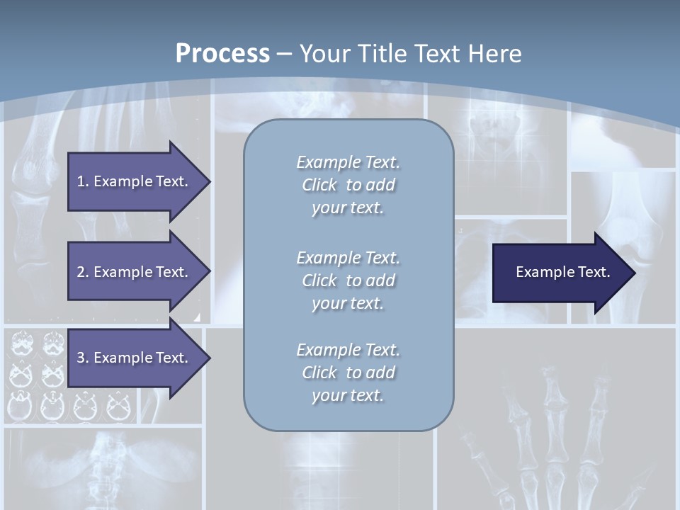 Radiation Shin Bones PowerPoint Template