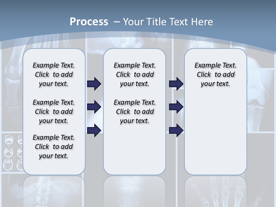 Radiation Shin Bones PowerPoint Template
