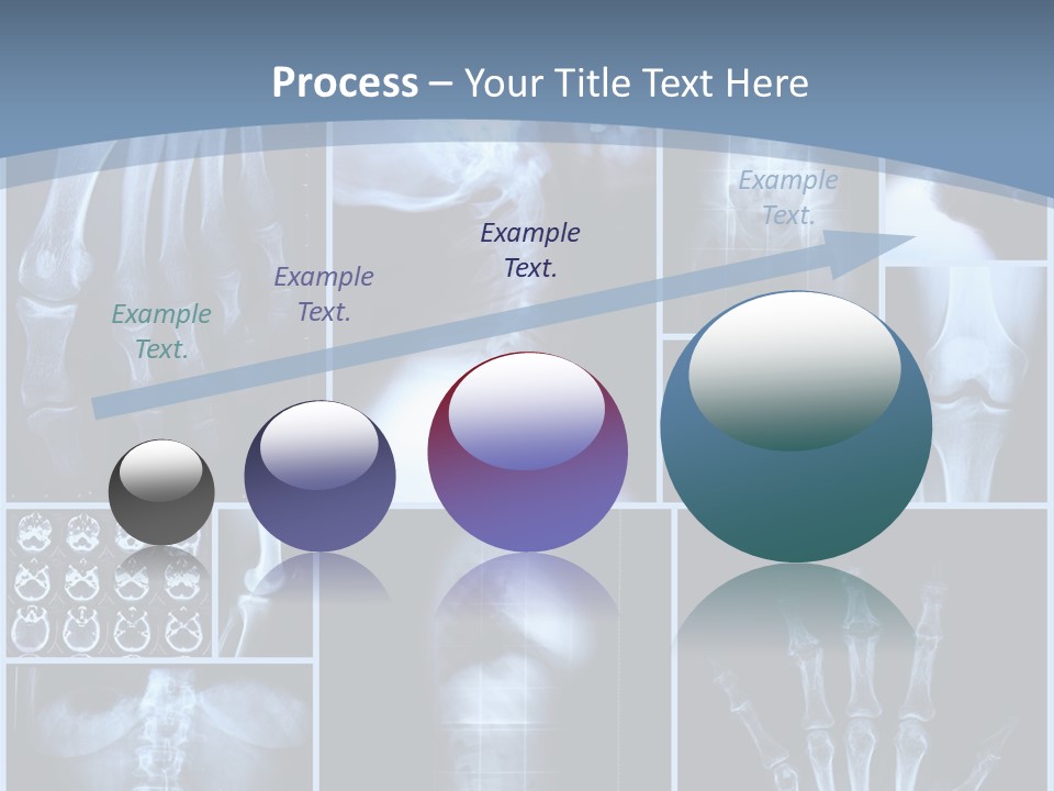 Radiation Shin Bones PowerPoint Template
