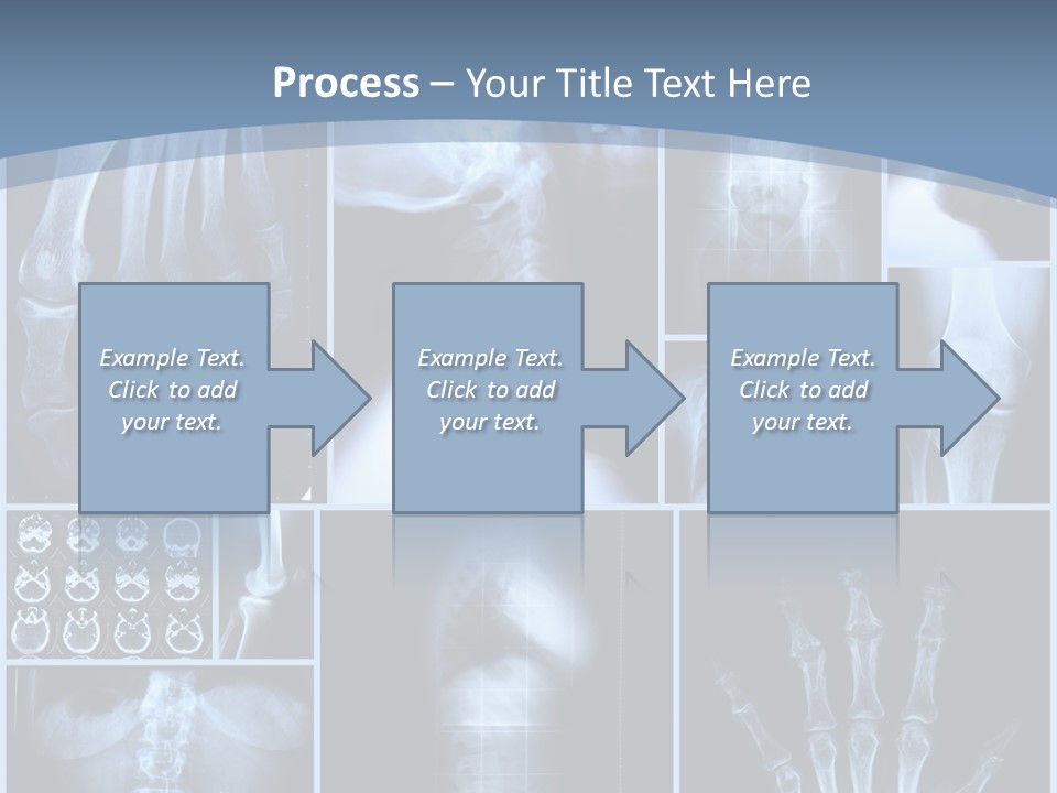 Radiation Shin Bones PowerPoint Template