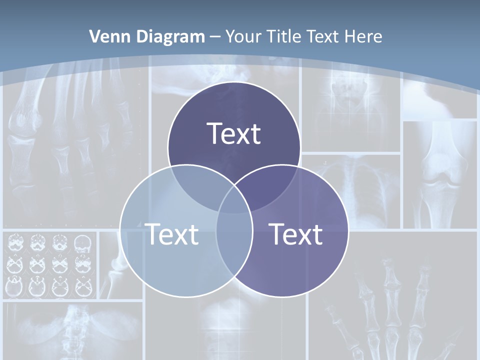 Radiation Shin Bones PowerPoint Template