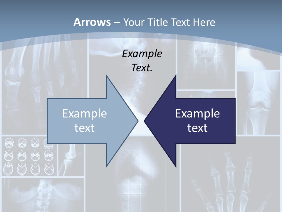 Radiation Shin Bones PowerPoint Template