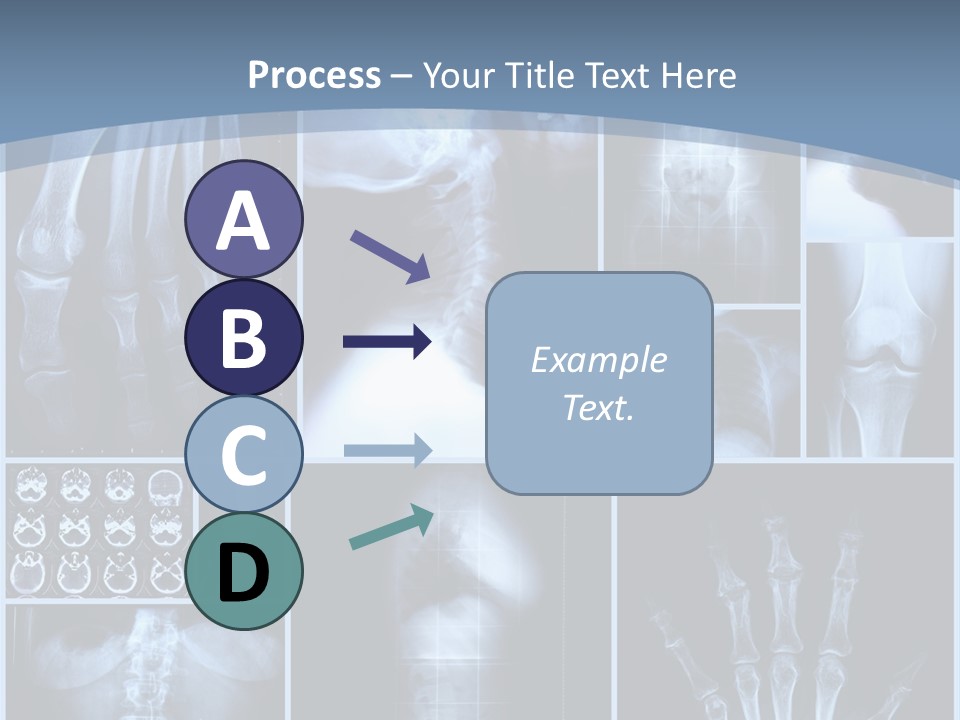 Radiation Shin Bones PowerPoint Template
