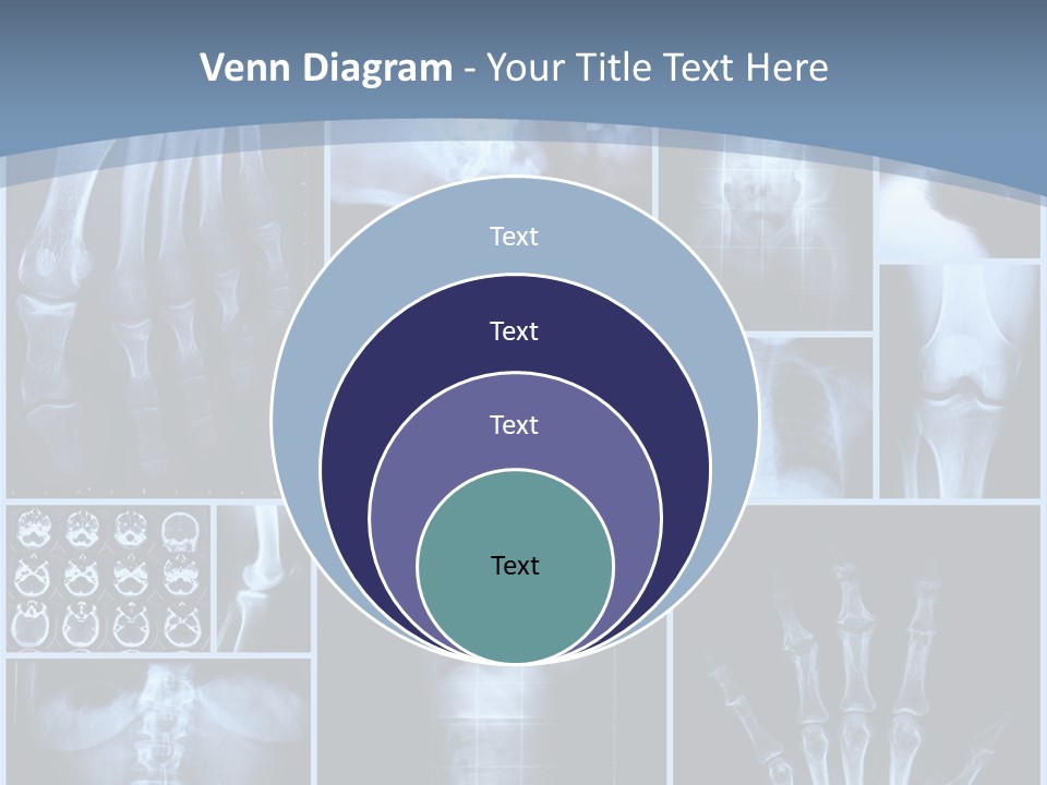 Radiation Shin Bones PowerPoint Template