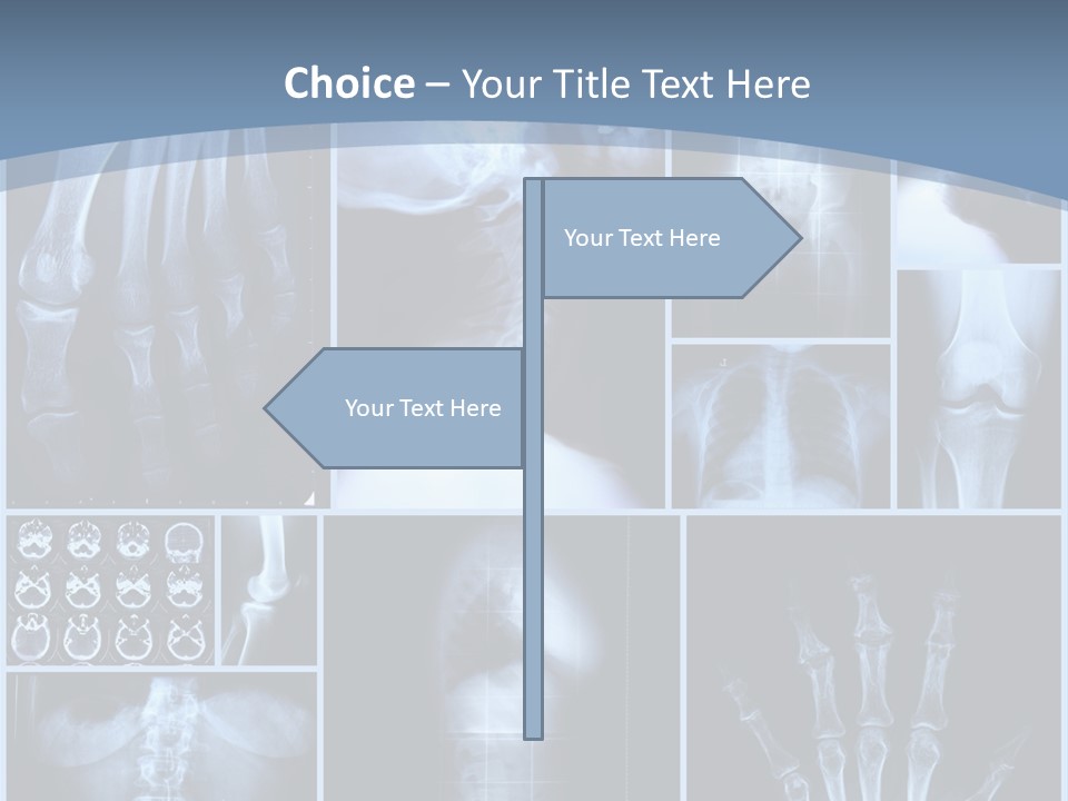 Radiation Shin Bones PowerPoint Template