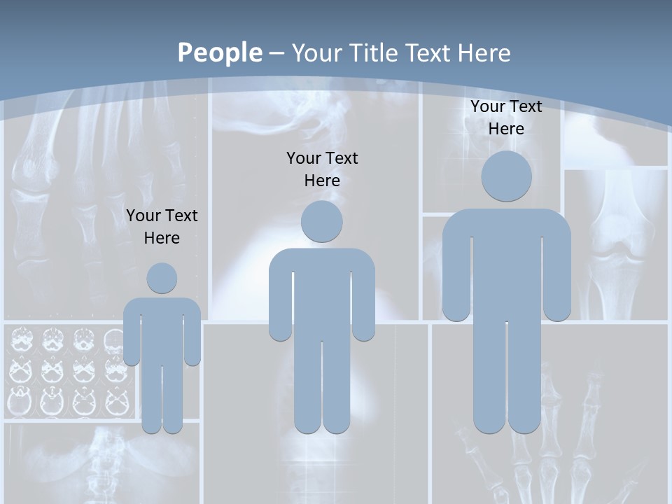 Radiation Shin Bones PowerPoint Template