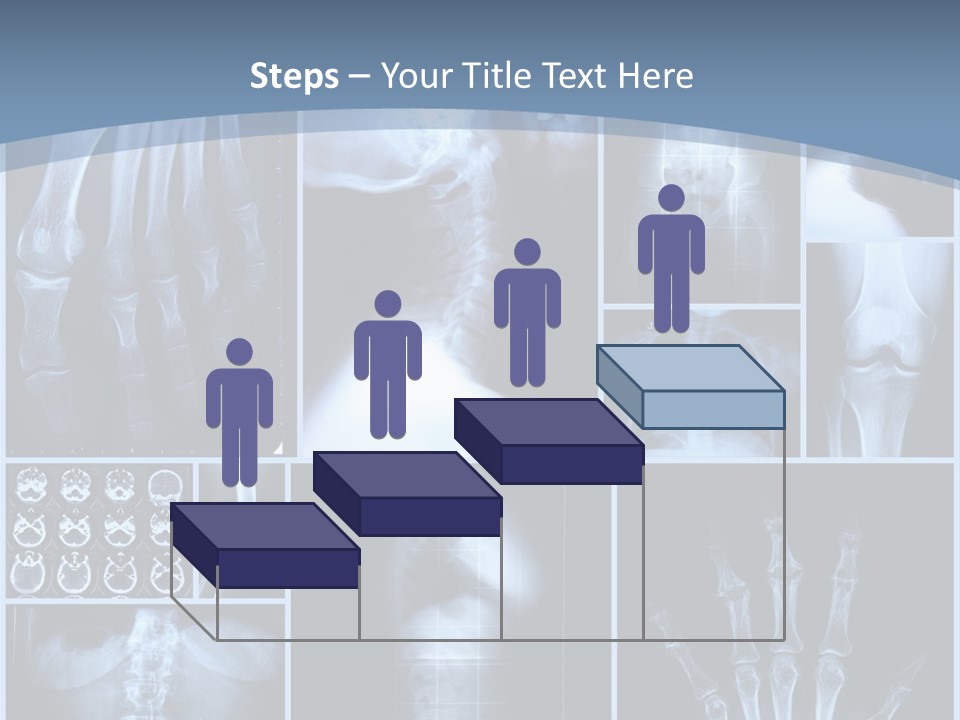 Radiation Shin Bones PowerPoint Template