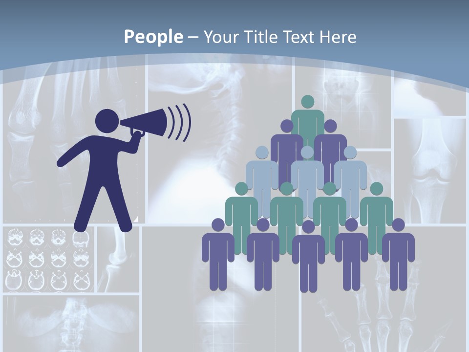Radiation Shin Bones PowerPoint Template