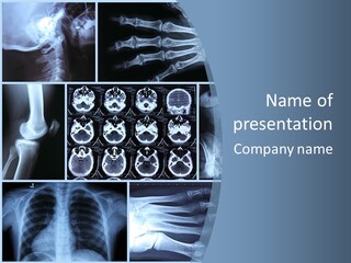 Medicin Radiology Radiation PowerPoint Template