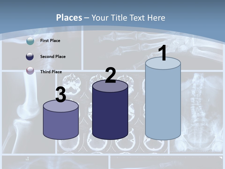 Medicin Radiology Radiation PowerPoint Template