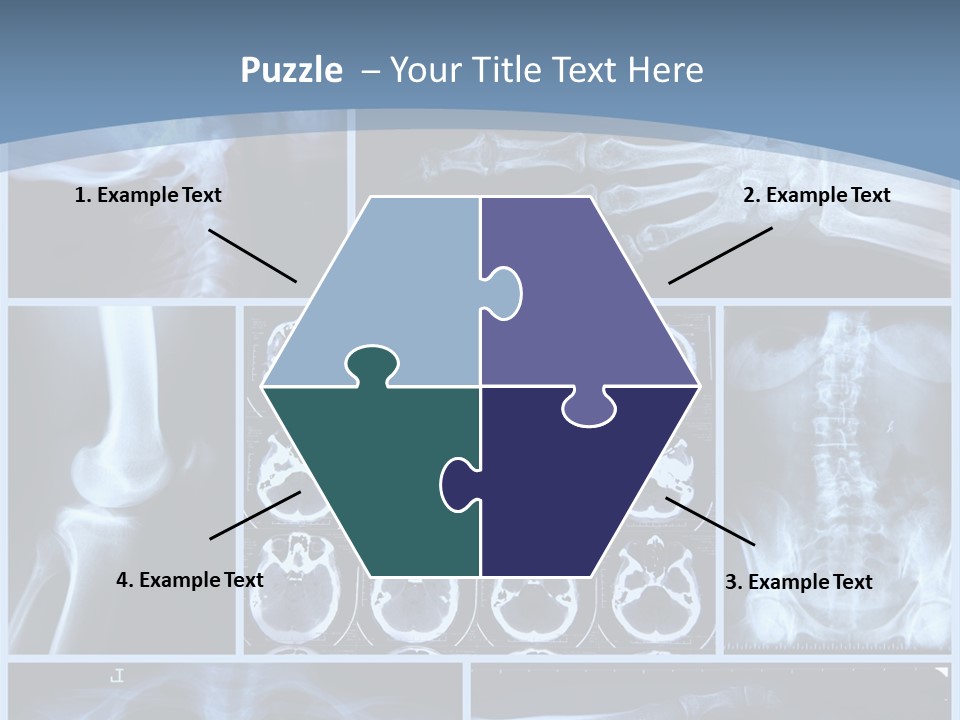 Medicin Radiology Radiation PowerPoint Template