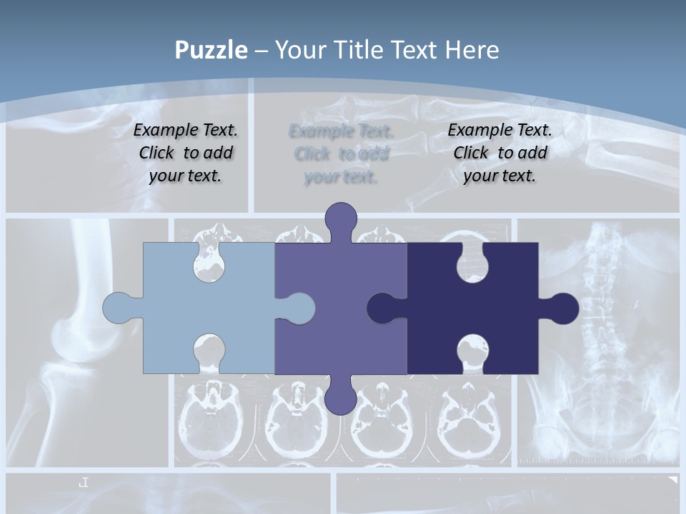 Medicin Radiology Radiation PowerPoint Template