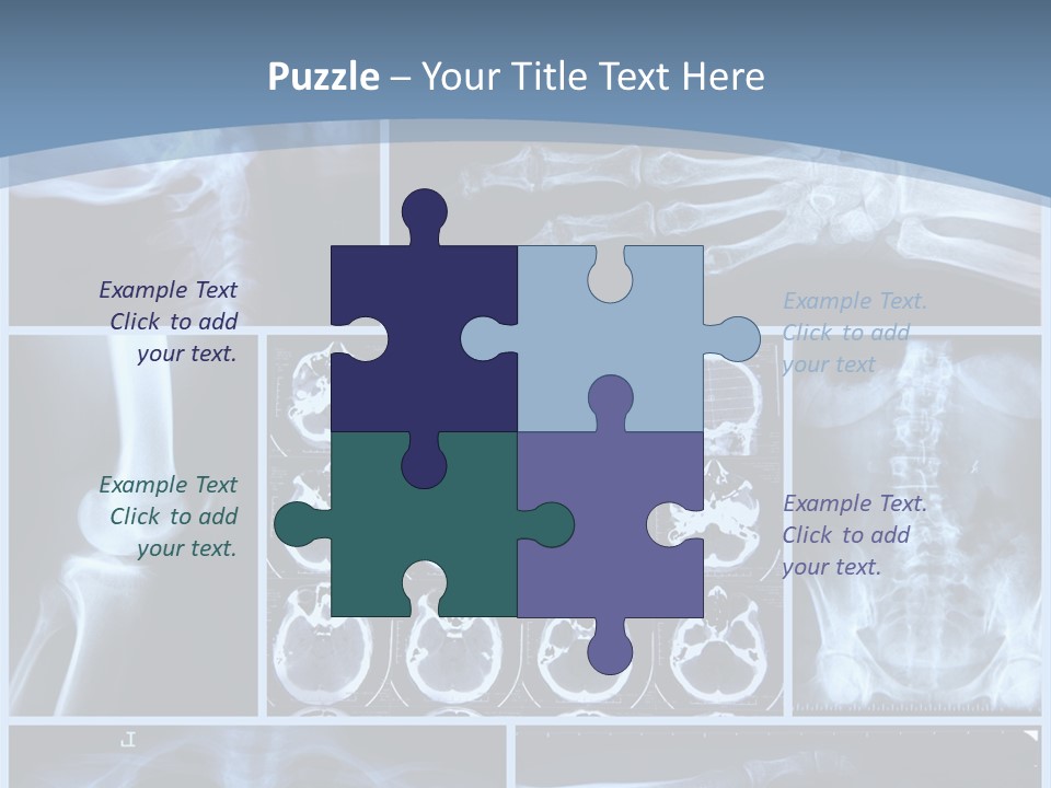 Medicin Radiology Radiation PowerPoint Template