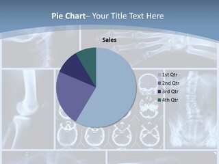 Medicin Radiology Radiation PowerPoint Template