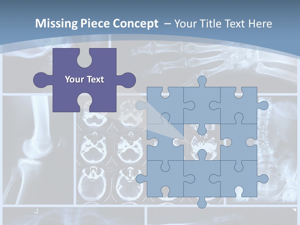 Medicin Radiology Radiation PowerPoint Template