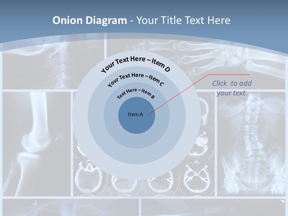 Medicin Radiology Radiation PowerPoint Template