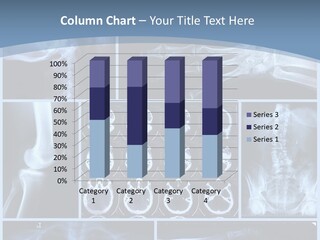 Medicin Radiology Radiation PowerPoint Template