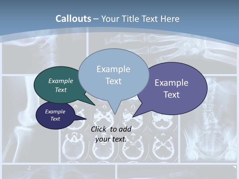 Medicin Radiology Radiation PowerPoint Template