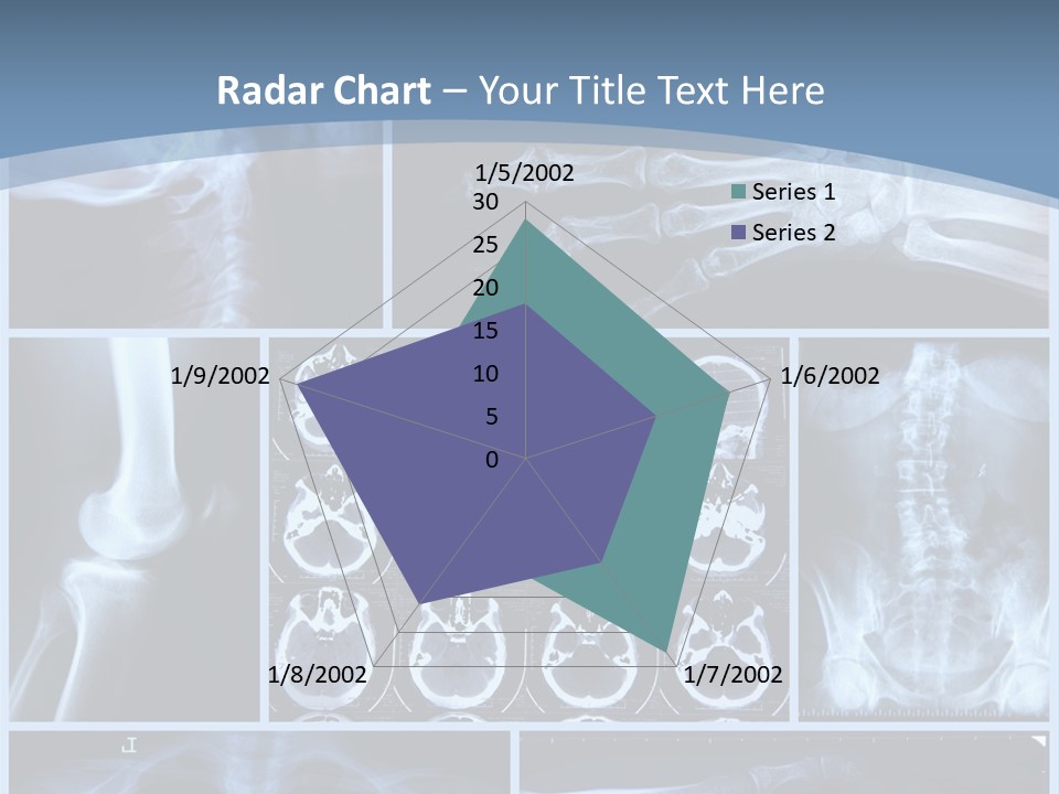 Medicin Radiology Radiation PowerPoint Template