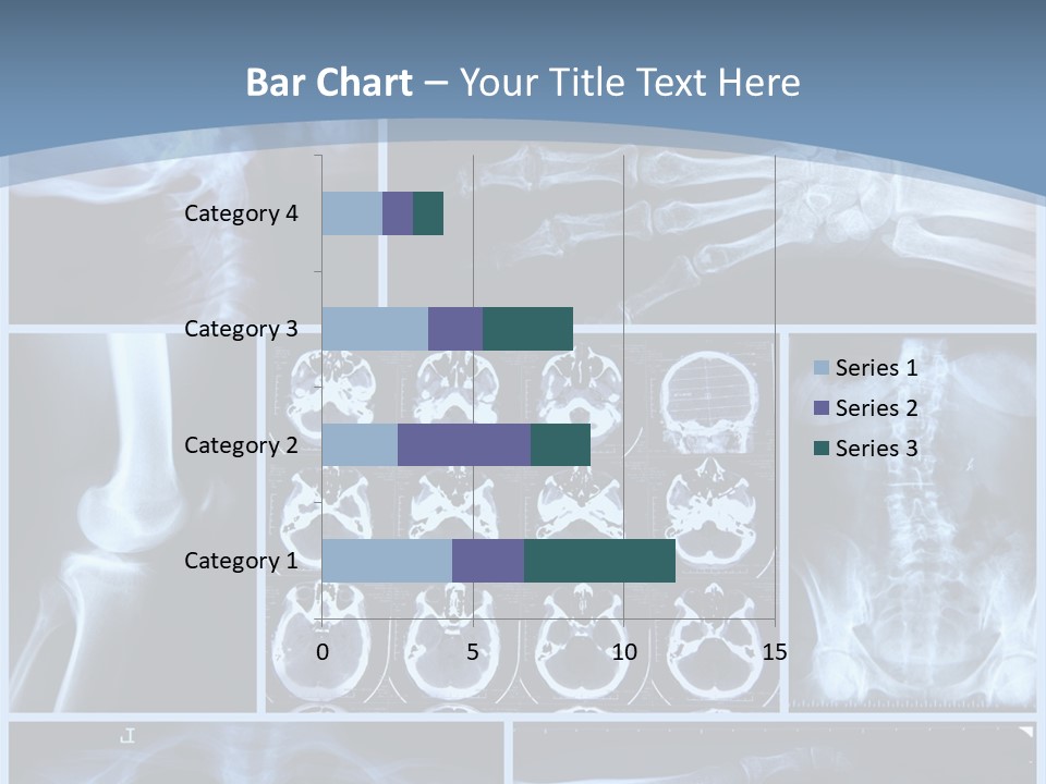 Medicin Radiology Radiation PowerPoint Template