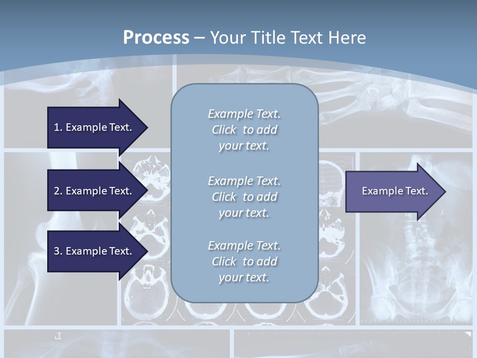 Medicin Radiology Radiation PowerPoint Template