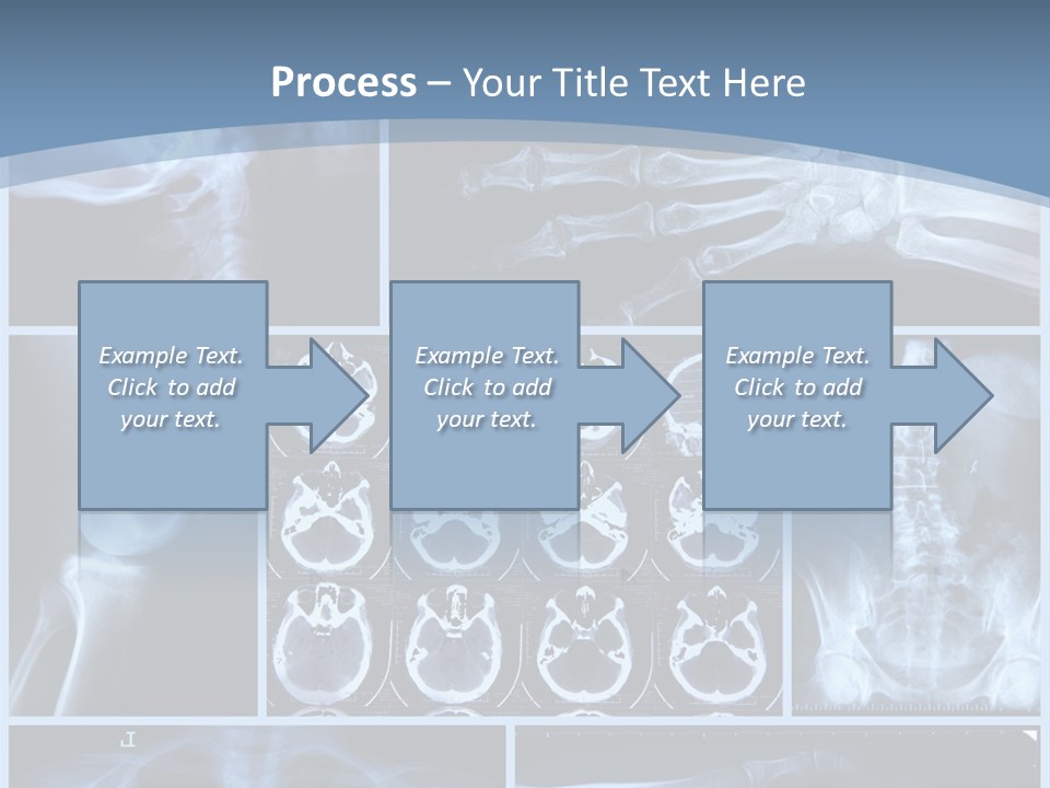 Medicin Radiology Radiation PowerPoint Template