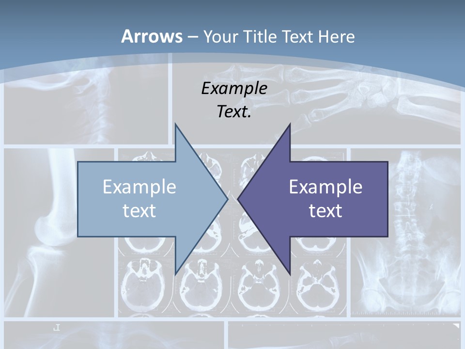 Medicin Radiology Radiation PowerPoint Template