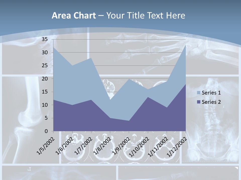 Medicin Radiology Radiation PowerPoint Template