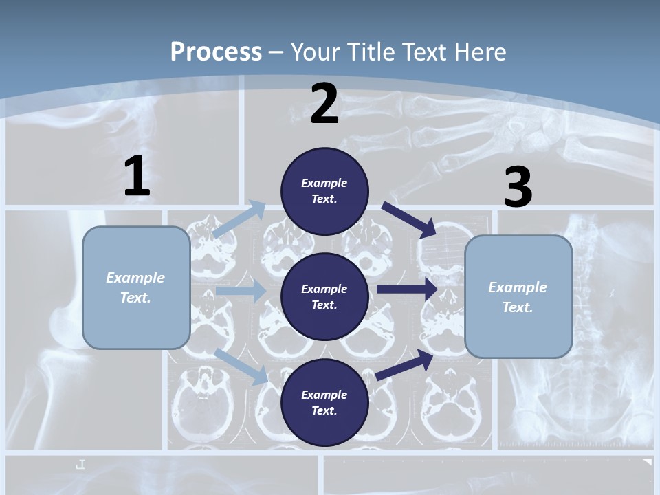 Medicin Radiology Radiation PowerPoint Template