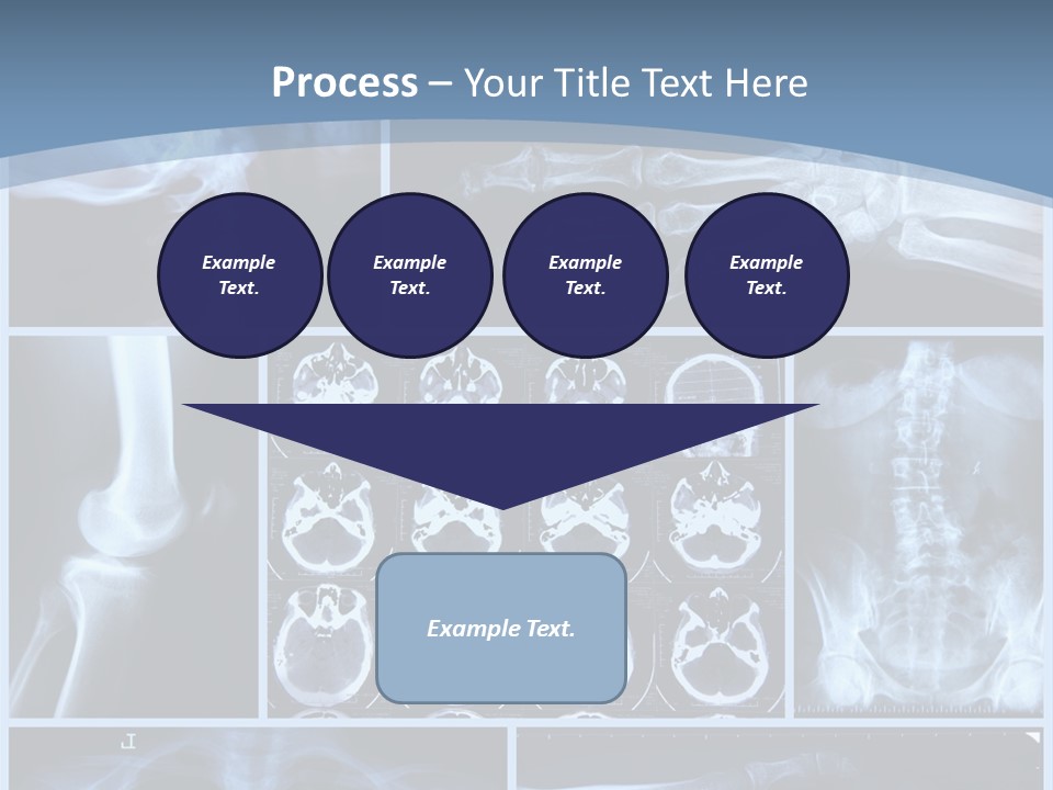 Medicin Radiology Radiation PowerPoint Template