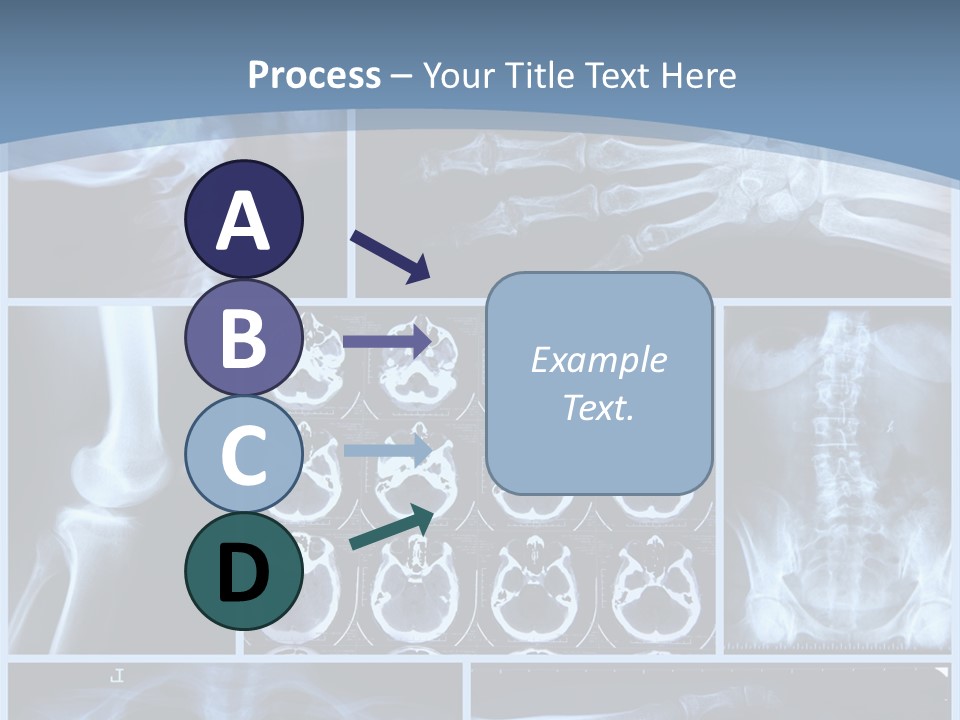 Medicin Radiology Radiation PowerPoint Template