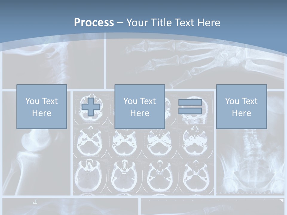 Medicin Radiology Radiation PowerPoint Template