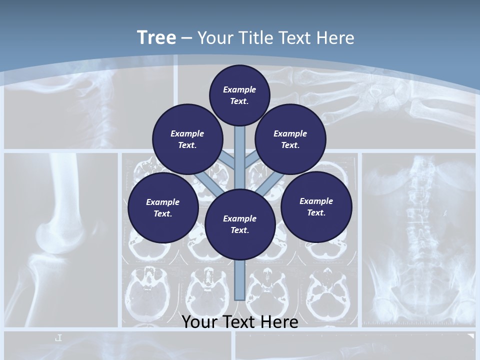 Medicin Radiology Radiation PowerPoint Template