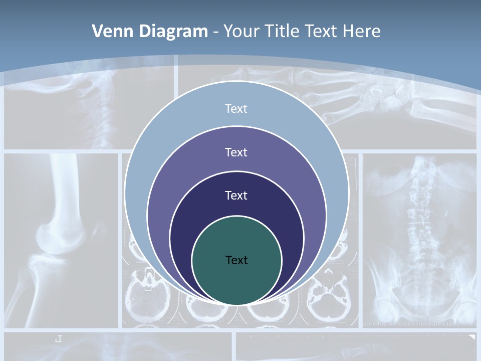 Medicin Radiology Radiation PowerPoint Template