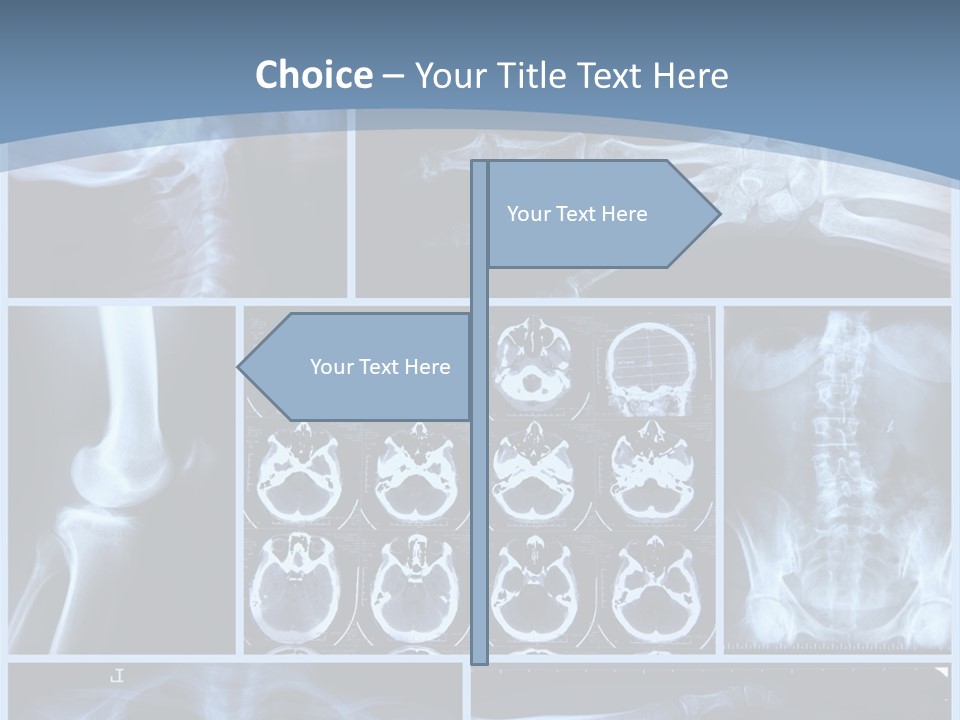 Medicin Radiology Radiation PowerPoint Template