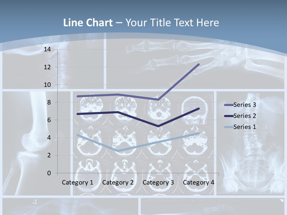 Medicin Radiology Radiation PowerPoint Template