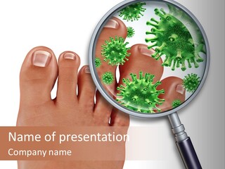 Fungal Nail Infection White Background PowerPoint Template