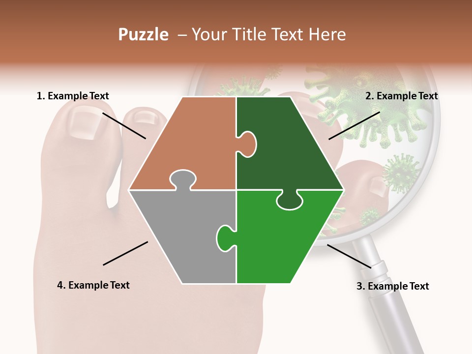 Fungal Nail Infection White Background PowerPoint Template