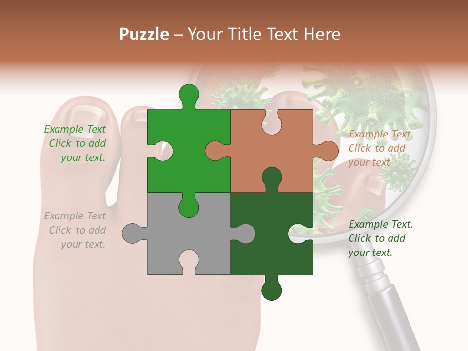 Fungal Nail Infection White Background PowerPoint Template