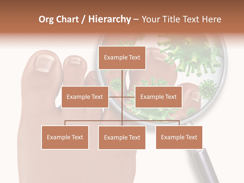 Fungal Nail Infection White Background PowerPoint Template