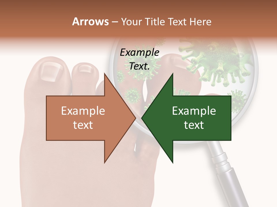 Fungal Nail Infection White Background PowerPoint Template