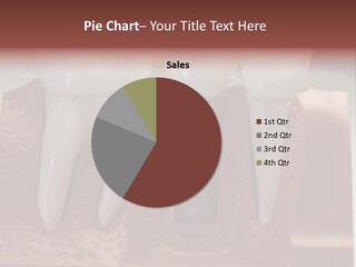 Crown Model Steel PowerPoint Template