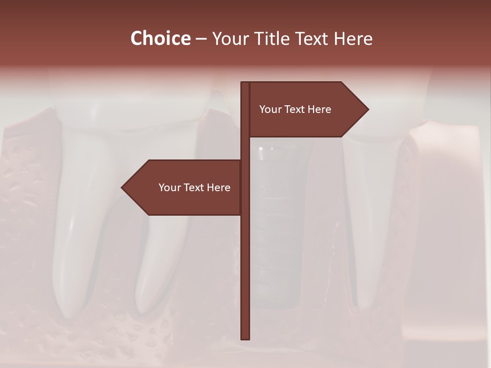 Crown Model Steel PowerPoint Template