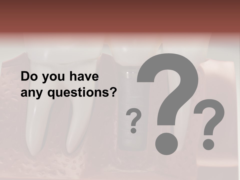 Crown Model Steel PowerPoint Template